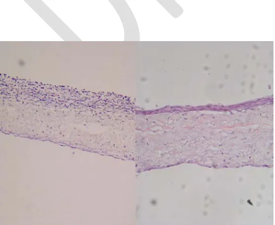 Fig. 1A. PHBV; the lower surface of the trilayer and growing well; oral keratinocytes are grown and stretched well on the upper layer of the trilayer Scanning electron micrograph (SEM) of electrospun scaffolds