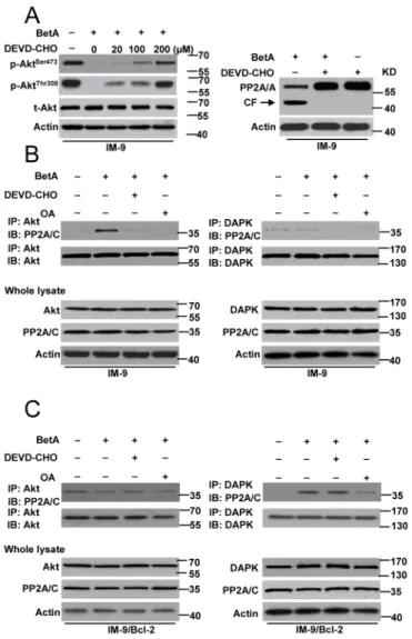 Figure 7: PP2A mediates autophagic cell death or apoptosis through regulating its connection with Akt and DAPK