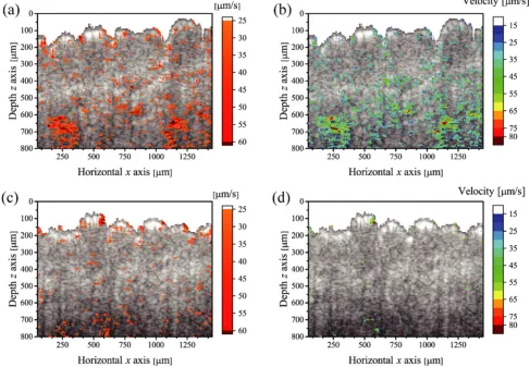 Figure 5. An example of standard deviation tomography of blood flow velocity and tomography of the temporal averaged blood flow velocity; (a) (b) control condition, (c) (d) avascularization condition, respectively