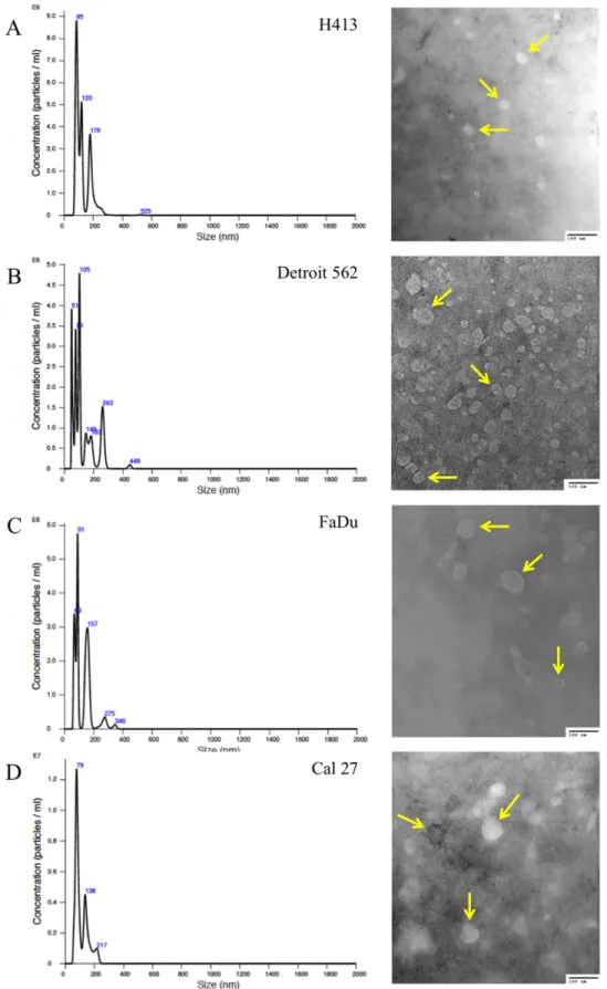 Figure 1: Size distribution plots from nanoparticle tracking analysis of exosome isolates from culture media of head  and neck squamous cell carcinoma (HNSCC) cell lines