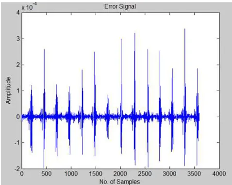 Figure 13. Error Signal (Global Thresholding and “db3” Wavelet). 