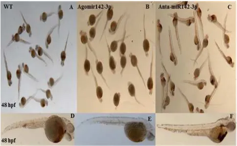 Figure 3. The o-staining result of miR-142-3p over expression at 48 hpf shows a severe blood formation blocking (A,D) wt control -lateral view (B,E) agomir142-3p injected embryos lacked staining completely- lateral view (C,F) antagomiR-142-3p injected embr
