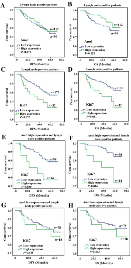 Figure 5: Kaplan-Meier survival analysis of Ano1 or Ki67 expression in breast cancer patients with lymph node  metastasis