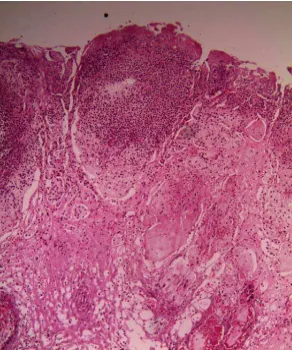 Fig 3. a split aligned along the line of the axial groove of the trimmed claw that is showing the steady improvement of the same lesion during day 0, 10 and 30