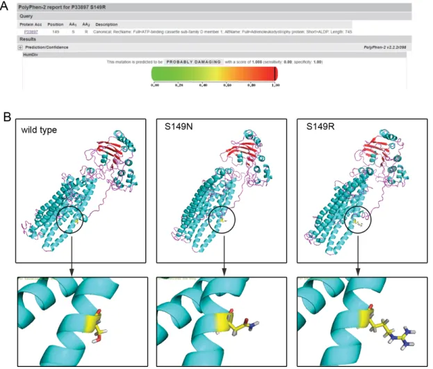Figure 3: Bioinformatics analysis.  (A) The prediction of the mutation effect by the PolyPhen software program showing a damaging  effect of the p.S149R mutation (score: 1.000 with a prediction: probably damaging)