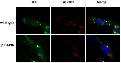 Figure 4: Subcellular localization of ABCD1 in CHO cells.  CHO cells were transfected with empty vector, pEGFP/ABCD1 (wild- (wild-type), or pEGFP/mutant-ABCD1 (p.S149R), and protein localization was observed by fluorescence microscopy