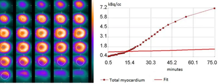 Figure 5: Representative of myocardial time-activity curve together with the  18  F-FDG kinetics fitted model curve 