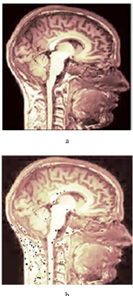 Figure 3. a. Original Image; b. Compressed Sample. 