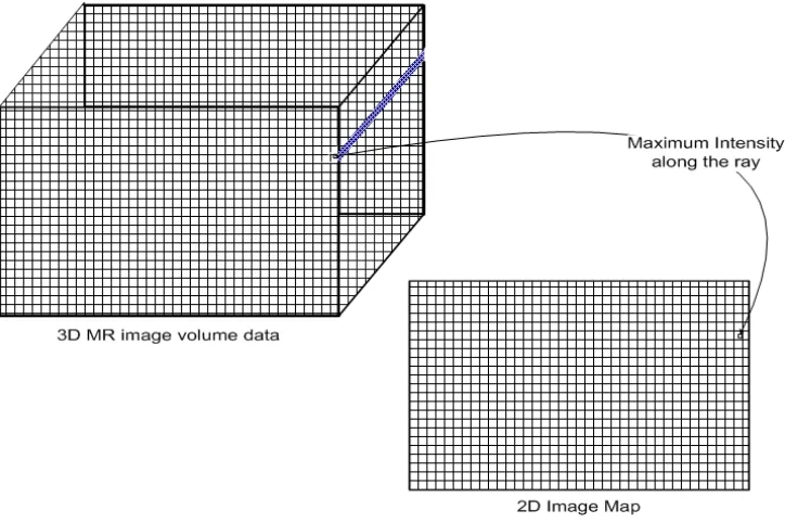 Figure 3. Maximum Intensity Projection (MIP). 
