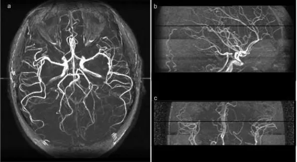 Figure 7. Visualization generate from Data Set 1 (512x64x512). The a, b and c shows the sagittal, coronal and axial views