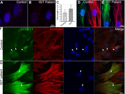 Fig. 1. Ciliogenesis analysis of patient-derived monociliated skin fibroblast cells and subcellular localization of CCDC11
