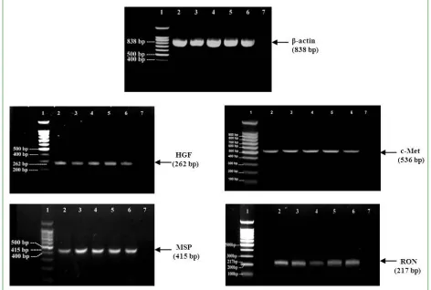 Table 1.  Localization of HGF, MSP, and their receptors c-Met and RON in hair bulb components