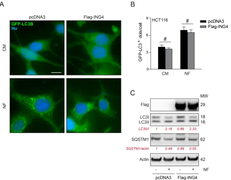 Figure 4: Overexpression of ING4 has not inhibitory effect on starvation induced autophagy