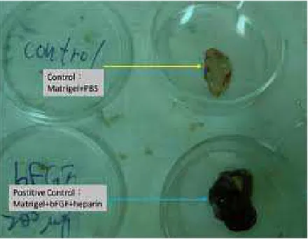 Figure 2. Sponge implantation method[90]