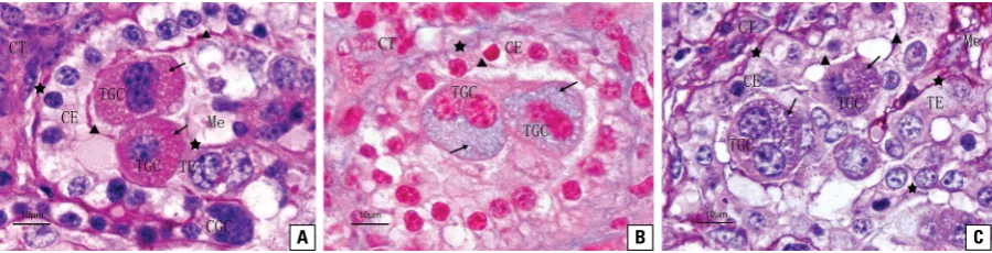 Figure 2. Histological section (H&E) of yak placentome showing that the chorionic plate projected the primary villi (PV), secondary villi (SV) and tertiary villi (TV) into the corresponding caruncular crypt (CC)