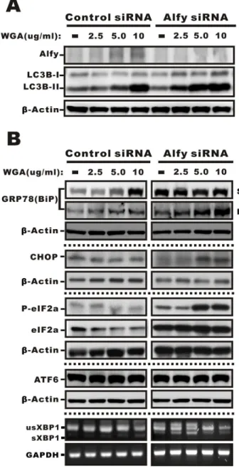 Figure 7: Effects of WGA on Alfy expression and the effects of Alfy knockdown ER stress-mediated cytoplasmic  vacuolation and the UPR