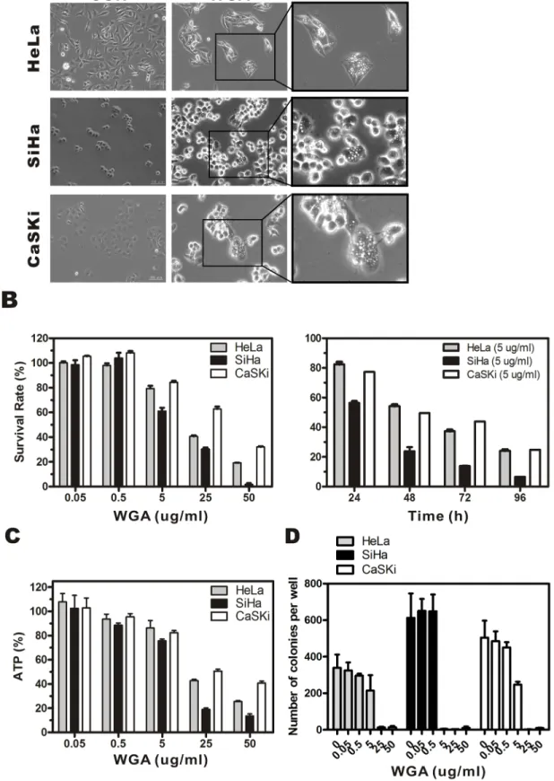 Figure 1: WGA induces formation of cytoplasmic vacuoles and paraptosis-like cell death in cervical carcinoma cells.
