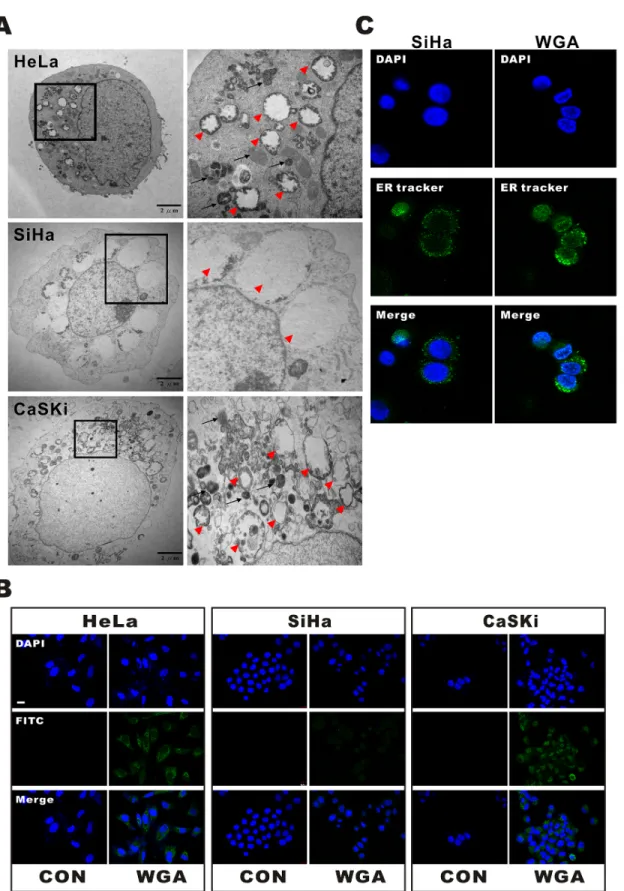 Figure 2: WGA induces both paraptosis and autophagy in HeLa and CaSKi cells, but only paraptosis in SiHa cells