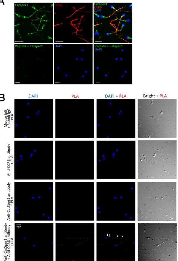 Figure 3: CCR6 interacts with CatSper1 in human sperm.  (A) Representative fluorescence images showing the localization of  CatSper1 (green) and CCR6 (red) in the principal and mid-piece of normal human sperm