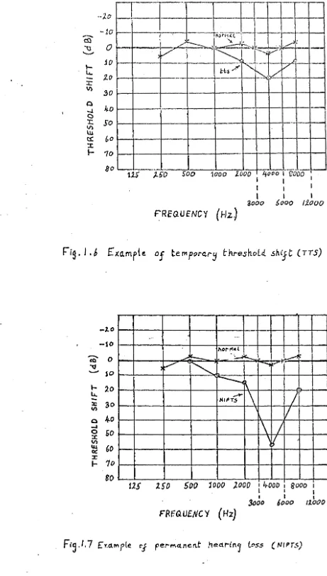 Fig. 1.6 Exa.mple of tempora.ry I:hreshold. sh'Jt (T;S) 