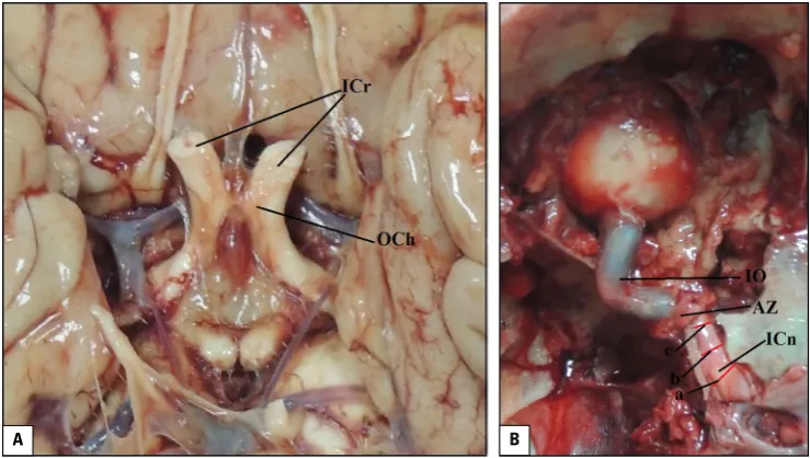 Figure 2. The right optic canal (OC); A. View from the middle cranial fossa. a and b represent the height and width of the cranial foramen of the OC, respectively