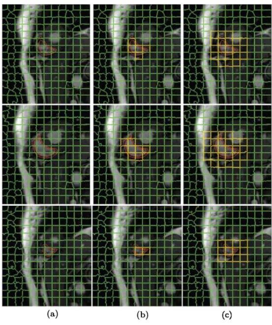 Fig. 2 a RV endocardium; b RV epicardium; c final segmentation.