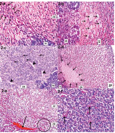 Figure 2. Sections of the zona reticularis (ZR) and adjoining medulla (M) (H&E); a. Spindle cell hyperplasia (arrows) in a rat group I-b (×400)