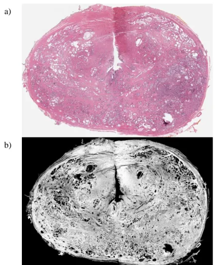 Figure 4.2: Histopathology slides with background information  removed. a) The original tumour containing histopathology slide of  prostate