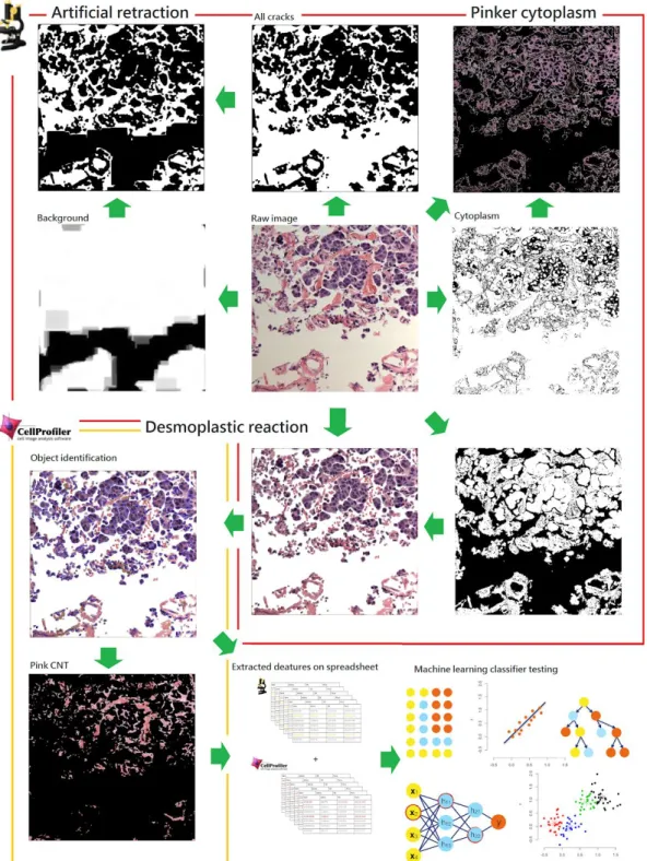 Fig. 5. Image processing methods for finding the features suggestive of tumor invasion in pathological  images