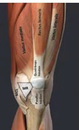 Figure 1. The quadriceps parts and medial structures of the knee: rectus femoris, vastus medialis, vastus lateralis, vastus interme-dius (deeper to rectus femoris), medial collateral ligament (MCL), medial retinaculum (MR).
