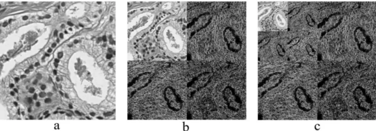 Figure 5. Haar wavelet transformation. (a) Original image converted from RGB to grayscale, which  was cropped from a whole slide tissue image and scanned at 40× optical magnification
