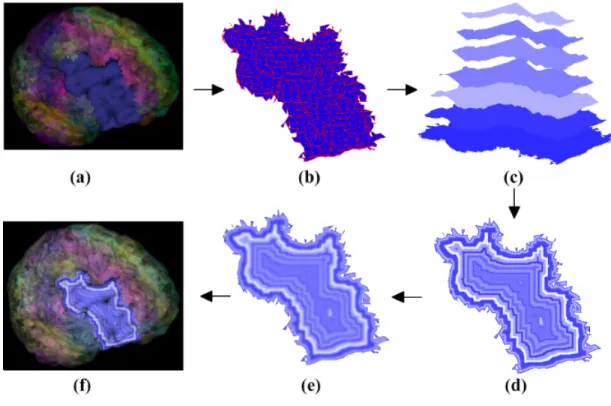 Fig. 4.4. (a) Original ROI. (b) ROI mapping. (c) Iterative erosion. (d) Overlaying. (e) Gaussian blurring