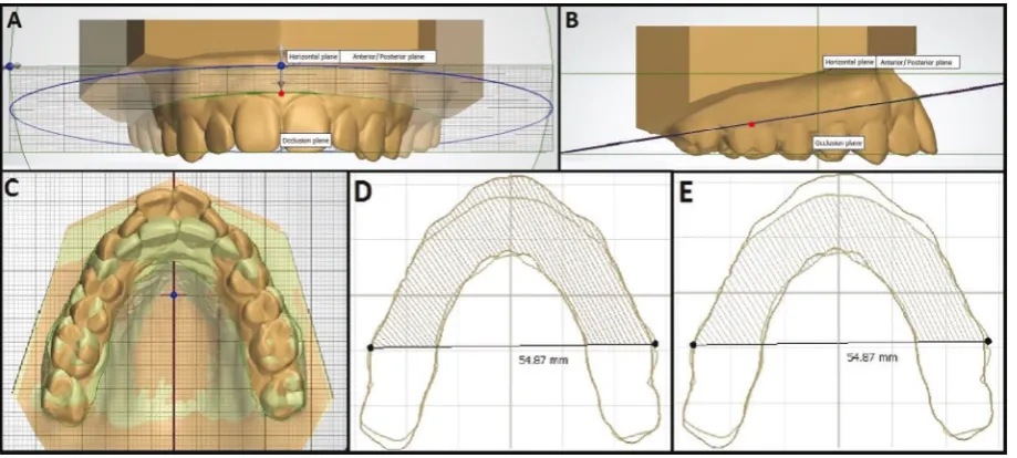 Figure 1. Definition of reference plane, three-dimensional superimposition of the images, delimitation of the measured area