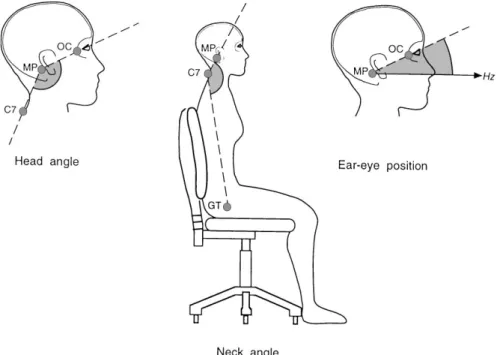 Fig. 2. Placement of markers and definitions of joint angles: OC"outer canthus of the eye, MP"mastoid process on a line joining tragus and outer canthus, C7"cervical spinous process VII, and GT"greater trochanter