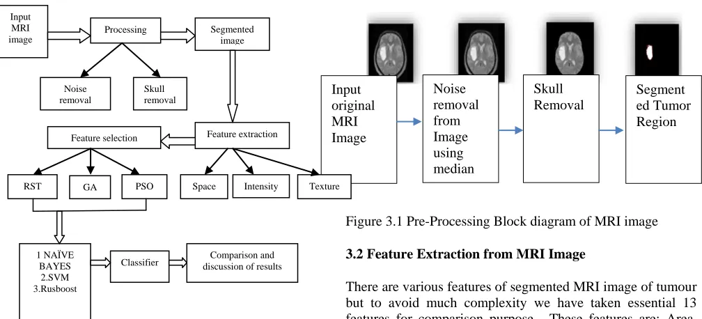 Figure 3.1 Pre-Processing Block diagram of MRI image 