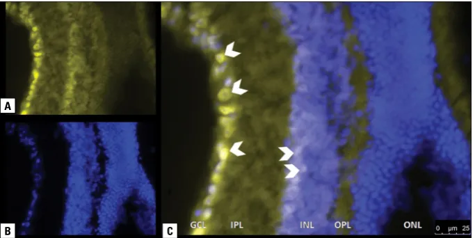 Figure 1. A section with no post-fixation. A. Vimentin labelled with Cy3; B. Nuclei stained with Hoechst; C
