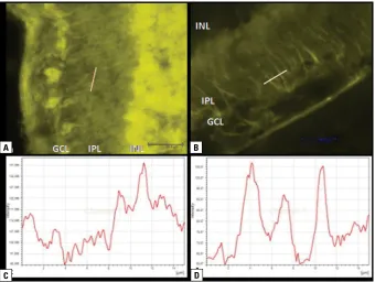 Figure 8. Densitometric analysis of fibrils positively labelled after methanol (A, C) and alcohol/acetic acid (AAA) (B, D) post-fixation