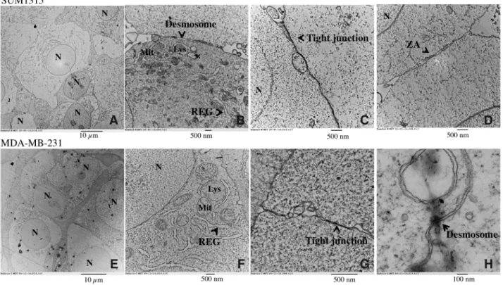 Figure 5: Ultrastructure of SUM1315 and MDA-MB-231 spheroids by Transmission Electron Microscopy (TEM)