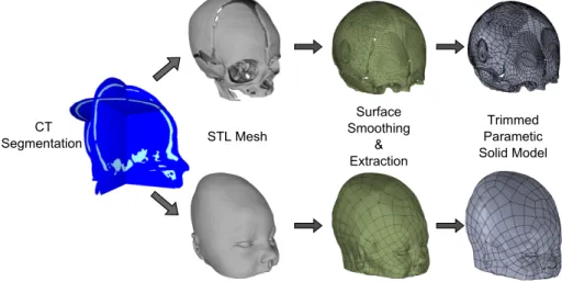 Figure 2.8: Workflow to create solid models from a CT segmentation for the design of the neonatal tank