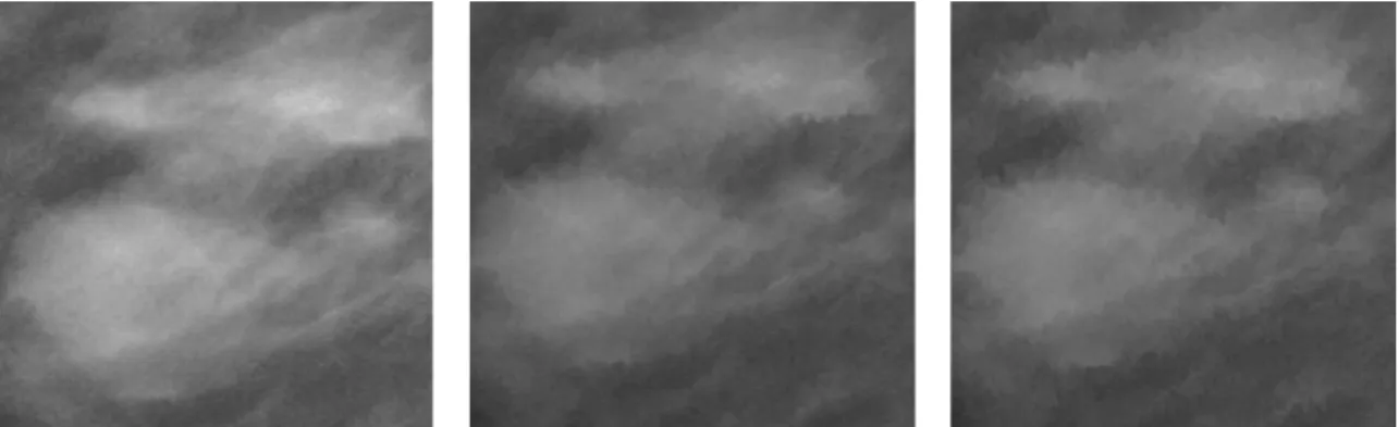 Figure 9. The raw mass image patch(left), image with 2-magnitude elastic  distortion(middle), image with 4-magnitude elastic distortion(right) 