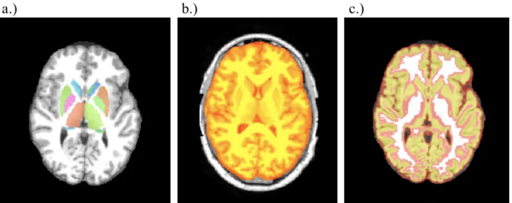 Figure 1.1: Aims of medical image segmentation on examples of segmented a) regions of interest, b) brain and c) grey matter.