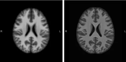 Figure 2.5: The same axial slice through the population templates created with DARTEL (left) and SyN (right).
