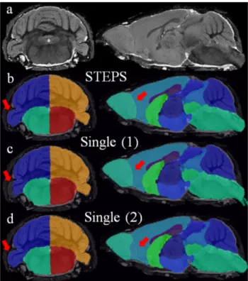 Figure 7. Sample images comparing the parcellation result of our framework and the single-atlas based methods