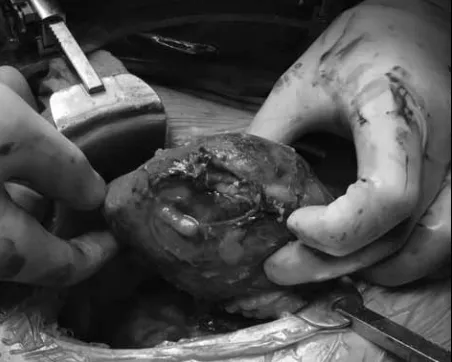 Fig. 2. MP-02.04. Process of salvaging damaged renal allografts.