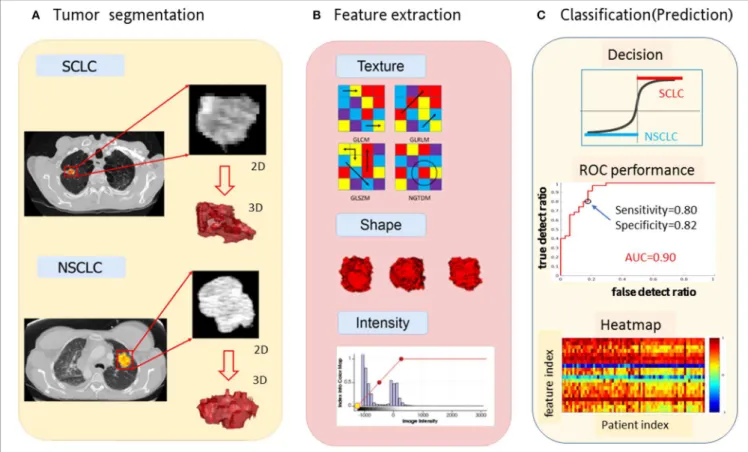 FIGURE 1 | Schema for lung cancer segmentation, radiomic feature extraction and predictive modeling
