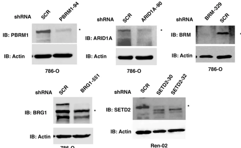 Fig 1. Validation of the antibodies used for IHC. Kidney cancer cell lines stably expressing control shRNA or shRNA against ARID1A, PBRM1, BRG1, BRM, and SETD2 were used for western blot analysis with indicated antibodies.