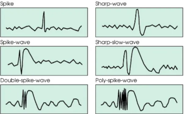 Figure 3.1 Various Forms of Inter-ictal discharges observed in EEG recordings (Elger &amp; 