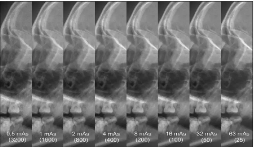 Figure 3   Images of a scull phantom: Over a dose range between 0.5 mAs and 63 mAs (factor 