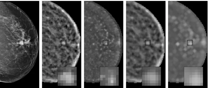 Figure 2.3. The effect of applying the proposed maximum filtering algorithm to the gradient-based feature image shown in Figure 2.1 (right)