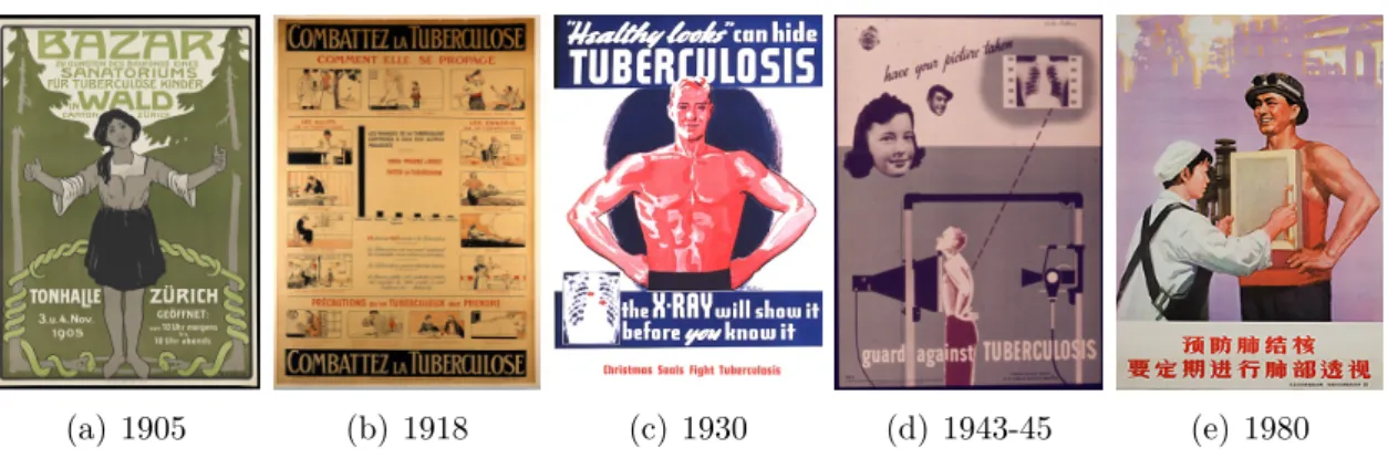 Figure 1.1: Tuberculosis awareness posters in 20th century from various countries.